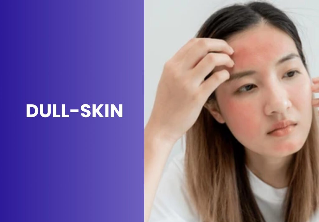 Dull skin girl