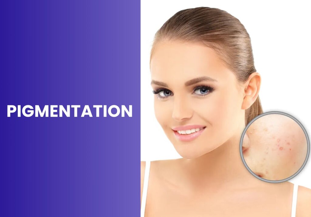 Pigmentation girl